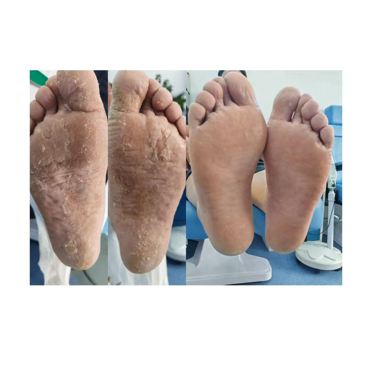 ������ν�����������3��